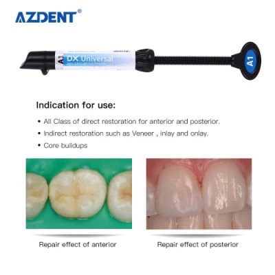 Résine Composite Hybride Photopolymérisable Dentaire Universelle Teinte A1, A2, A3, A3.5, B1, B2